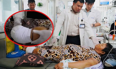Hỗ trợ viện phí cho người phụ nữ bán vé số bị hoại tử bàn chân