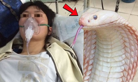 Bị rắn trắng cắn khi đang hái chè, nữ công nhân cấp cứu nguy kịch