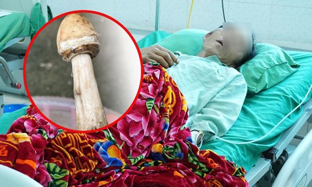 4 người trong một gia đình nhập viện sau bữa cơm có nấm lạ