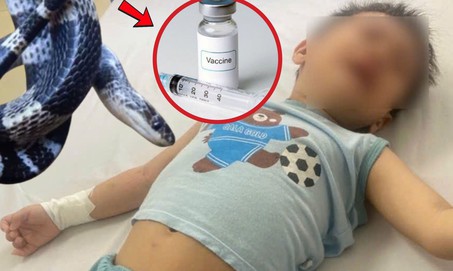 Ấn Độ: Bé trai 4 tuổi bị rắn cắn, nhưng bị tiêm nhầm vaccine phòng dại