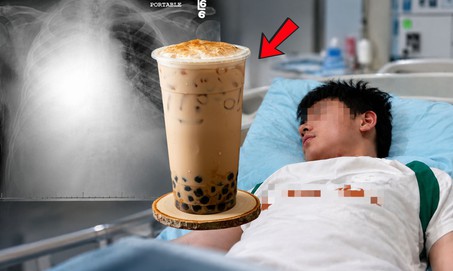 Ngày nào cũng uống loại nước quen thuộc, người đàn ông 35 tuổi gan trắng xóa