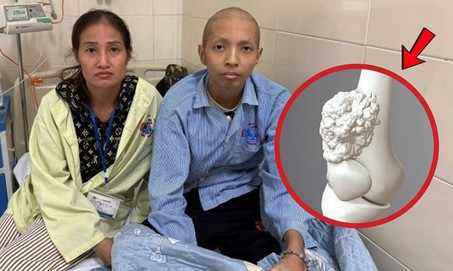 Cậu bé 16 tuổi mồ côi cha từ nhỏ phải cắt một phần chân vì ung thư