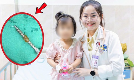Bé gái 30 tháng tuổi suýt thủng đường tiêu hóa vì nuốt đinh vít 3cm khi chơi