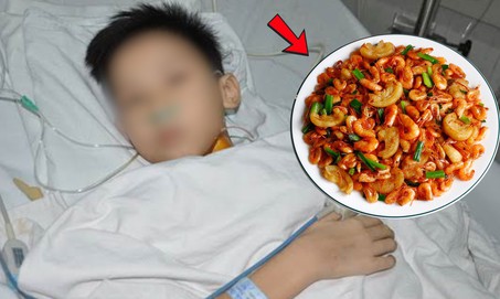Ăn tôm đồng, bé trai 14 tuổi mẩn đỏ toàn thân nhập viện nguy kịch