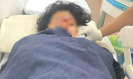 Nữ sinh lớp 9 bị bạn dùng dao chém đa chấn thương hiện ra sao?