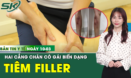 Bản Tin Y Tế 10/3: Tiêm filler để làm thẳng chân, cô gái 29 tuổi biến dạng cẳng chân