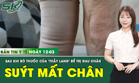 Bản Tin Y Tế 12/3: Suýt mất chân sau khi đến 'thầy lang' bó thuốc
