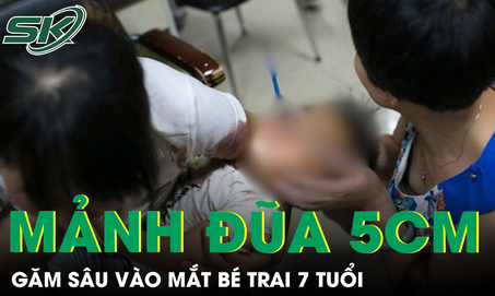 Gắp mảnh đũa gãy dài 5cm trong mắt bé trai 7 tuổi 