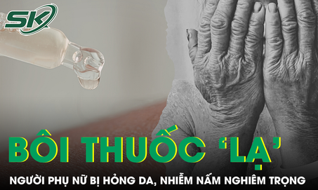 Người phụ nữ bị hỏng da, nhiễm nấm nghiêm trọng sau khi bôi "thuốc lạ"