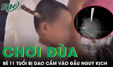 Hai anh em chơi đùa tại nhà, bé 11 tuổi bị dao cắm vào đầu nguy kịch