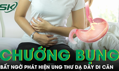 Chướng bụng kéo dài, người phụ nữ 48 tuổi bất ngờ phát hiện ung thư dạ dày di căn