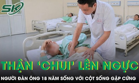 Ca tán sỏi nghẹt thở cho người đàn ông có thận 'chui' lên ngực 