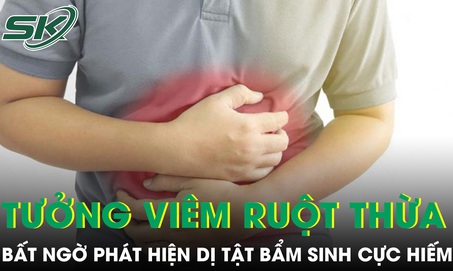 Đau bụng tưởng viêm ruột thừa cấp, bất ngờ phát hiện mắc dị tật bẩm sinh chỉ 2% người mắc 