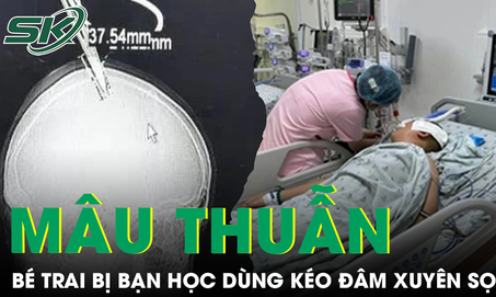 Mâu thuẫn trong lớp, bé trai bị bạn học dùng kéo đâm xuyên sọ