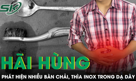 Đau bụng âm ỉ, người đàn ông khiến bác sĩ sốc khi trong dạ dày có nhiều bàn chải và thìa inox