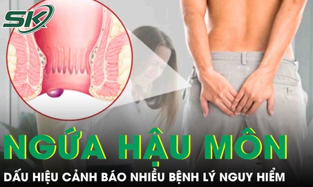 Ngứa hậu môn kéo dài có thể là dấu hiệu cảnh báo nhiều bệnh lý nguy hiểm