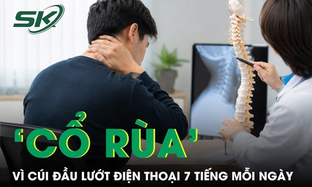 Cúi đầu lướt điện thoại 7 tiếng/ngày, nam thanh niên mất tự tin vì 'cổ rùa'