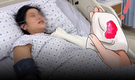 Suốt 1,5 năm bỏ qua dấu hiệu nhỏ này, người phụ nữ phát hiện mắc ung thư