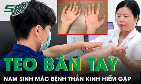 Nam sinh 17 tuổi bàn tay teo nhỏ dần do mắc căn bệnh thần kinh hiếm gặp
