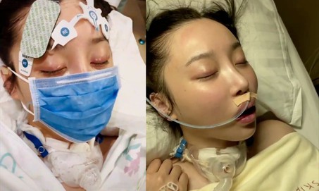 Từng bị ngừng tim hôn mê 3 tháng, nữ diễn viên hồi phục trở lại phim trường