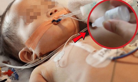 Bé gái 19 tháng tuổi cấp cứu ngưng thở vì ngộ độc thuốc nhỏ mũi