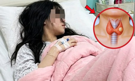 Mới 19 tuổi đã mắc ung thư tuyến giáp