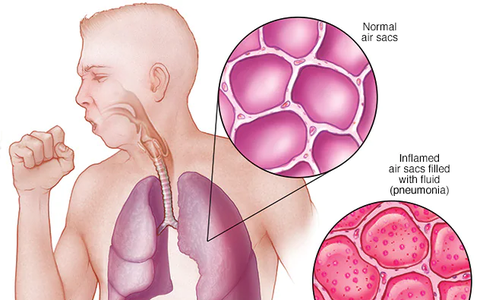 Suy Giảm Sức Khỏe: Nguyên Nhân, Dấu Hiệu và Giải Pháp Hiệu Quả