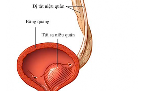 Kết luận