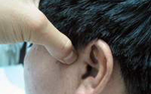 XOA BÓP HUYỆT ĐẠO GIẢM NGAY CẢM GIÁC CHÓNG MẶT KHÓ CHỊU