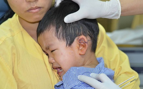 Cách sơ cứu cho trẻ khi bị vật sắc nhọn đâm, cha mẹ cần biết