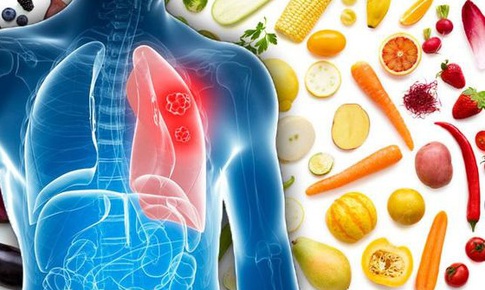 8 thực phẩm người bệnh ung thư phổi nên ăn thường xuyên