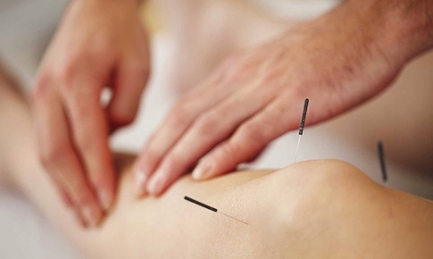 Điều trị tràn dịch khớp gối thể nhẹ bằng phương pháp y học cổ truyền