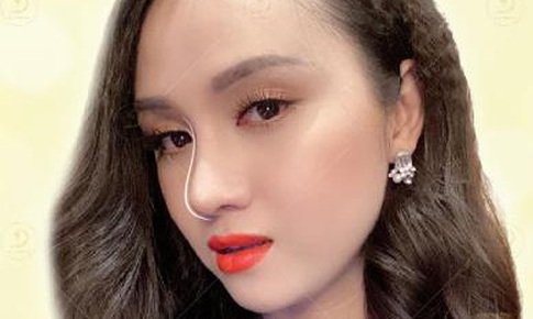 Sụn nâng mũi nên lựa chọn loại nào?