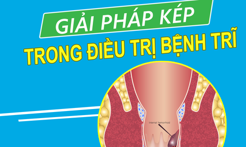 Giải ph&#225;p k&#233;p trong điều trị bệnh trĩ