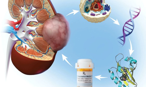 FDA phê chuẩn thuốc mới điều trị ung thư thận