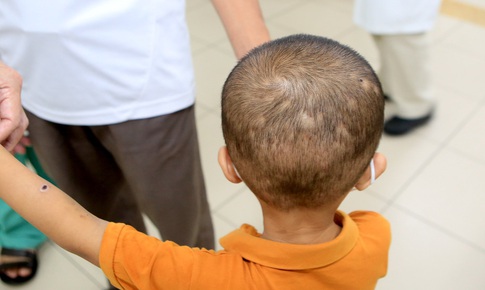 Trèo cây hái nhãn, bé trai bị ong đốt túi bụi 50 vết