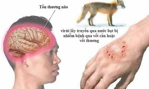 Nghệ An: Xử nghiêm cơ sở, cá nhân tuyên truyền sử dụng thuốc Nam để điều trị bệnh dại