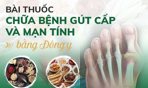 Thuốc trị bệnh g&#250;t bằng Đ&#244;ng y phối chế hơn 50 thảo dược tự nhi&#234;n