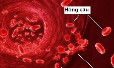 Tổn thương hệ tạo máu ở người bệnh lupus ban đỏ hệ thống