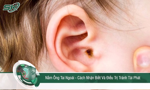 Nấm ống tai ngo&#224;i - C&#225;ch nhận biết v&#224; điều trị, tr&#225;nh t&#225;i ph&#225;t