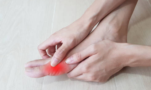 Dấu hiệu nhận biết gout cấp v&#224; c&#225;ch điều trị