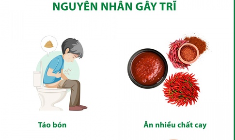 Th&#243;i quen xấu khiến nhiều người c&#243; nguy cơ mắc bệnh trĩ