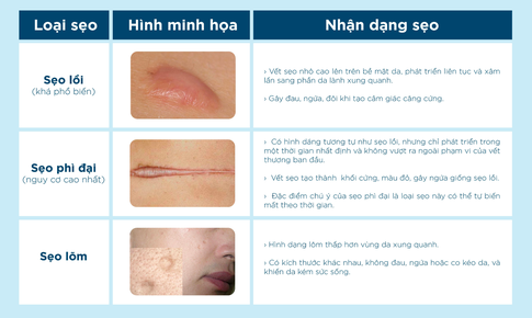 Từ chuy&#234;n gia trị sẹo: 4 tuần – 2 lời khuy&#234;n gi&#250;p l&#224;nh sẹo hiệu quả