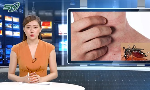 Virus sốt rét ác tính ở du học sinh trở về từ châu Phi