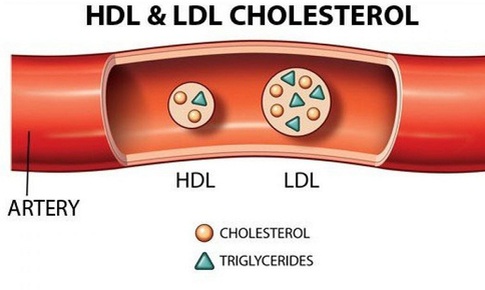 Rối loạn lipid m&#225;u - căn bệnh nguy hiểm h&#224;ng triệu người mắc phải