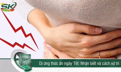 Dị ứng thức ăn ng&#224;y Tết: C&#225;ch nhận biết v&#224; xử tr&#237;