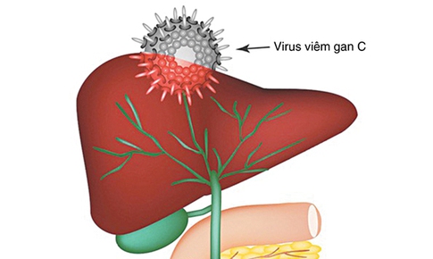 Mắc vi&#234;m gan C c&#243; l&#226;y cho người th&#226;n trong gia đ&#236;nh kh&#244;ng?