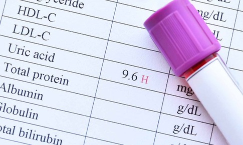 Acid uric cao l&#224; bệnh g&#236;?