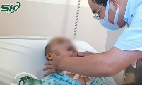 Không thể ăn uống, hơi thở có mùi nồng nặc người phụ nữ phát hiện mắc ung thư giai đoạn cuối