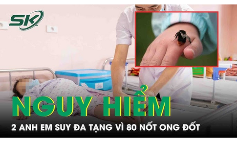 2 trẻ suy đa tạng do ong đốt